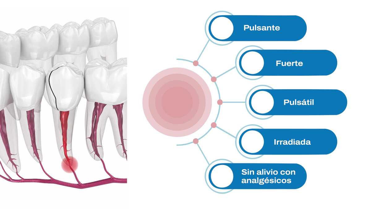 Ilustração odontológica com mapa visual de sintomas em espanhol